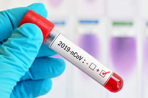 word health organisation (W.H.O.) online training for corona virus COVID-19 reporting and handling treatments