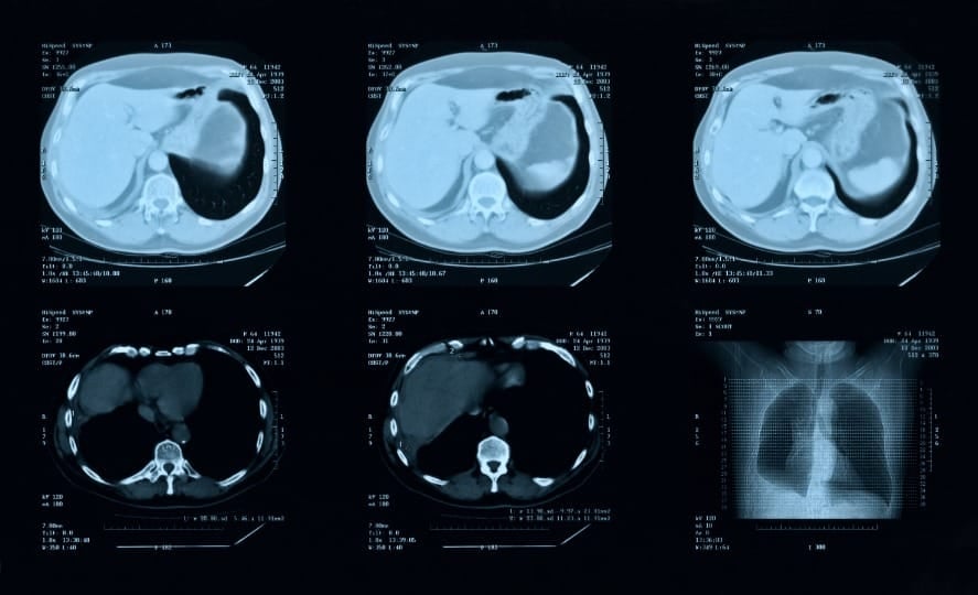 AI in radiology; top 10 uses of artificial intelligence in the medical device industry